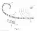 Fig. 02 - Cochlear implant