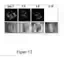 Fig. 13 - Nanosecond pulsed electric fields cause melanomas to self-destruct