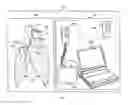 Fig. 02 - Obstructive sleep apnea treatment devices, systems and methods