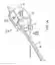 Fig. 04 - Obstructive sleep apnea treatment devices, systems and methods