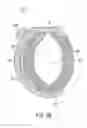 Fig. 05 - Obstructive sleep apnea treatment devices, systems and methods