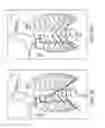 Fig. 09 - Obstructive sleep apnea treatment devices, systems and methods