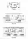 Fig. 14 - Obstructive sleep apnea treatment devices, systems and methods