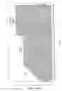 Fig. 17 - Obstructive sleep apnea treatment devices, systems and methods