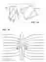 Fig. 09 - NON-INVASIVE NERVE STIMULATION