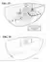 Fig. 16 - NON-INVASIVE NERVE STIMULATION