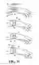 Fig. 24 - NON-INVASIVE NERVE STIMULATION