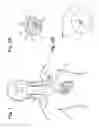 Fig. 02 - Implantable neurostimulator-implemented method for managing bradycardia through vagus nerve stimulation