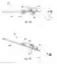 Fig. 17 - Devices, systems, and methods for improving pelvic floor dysfunction