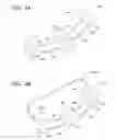 Fig. 04 - Cochlear implant