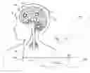 Fig. 01 - System and apparatus for increasing regularity and/or phase-locking of neuronal activity relating to an epileptic event