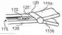 Fig. 01 - Endoscopic sympathectomy systems and methods