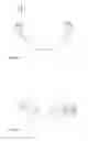 Fig. 04 - BREATHING GLASSES FOR PURIFYING AIR
