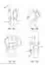 Fig. 08 - Apparatus, system, and method for pulley exercise equipment improvement