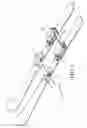 Fig. 02 - Ski binding rescue device