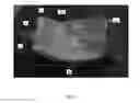 Fig. 03 - Composite woven fluidic device