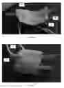 Fig. 07 - Composite woven fluidic device