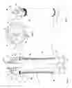 Fig. 02 - Ceramic hydrocyclone