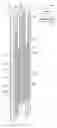 Fig. 01 - JETTING DISPENSING SYSTEM INCLUDING FEED BY PROGRESSIVE CAVITY PUMP AND ASSOCIATED METHODS