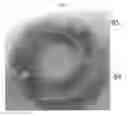 Fig. 07 - Hand grinder and method of coupling grinding disc of hand grinder