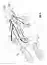 Fig. 06 - Wrist and jaw assemblies for robotic surgical systems