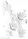 Fig. 17 - Wrist and jaw assemblies for robotic surgical systems