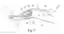 Fig. 04 - Laminating device and a method for laminating a decor layer onto a carrier part