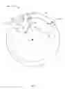Fig. 06 - Bicycle rim and wheel having inner protrusions
