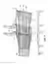 Fig. 10 - Infant carrier transport