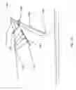 Fig. 16 - Watercraft immobilizing apparatus and system