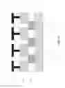 Fig. 06 - MEMS device and method of manufacturing a MEMS device