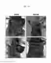 Fig. 20 - Compound having BLT inhibitory activity and composition, for preventing or treating inflammatory diseases, comprising same as active ingredient