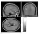 Fig. 01 - Compositions and methods for treating neurodegenerative diseases