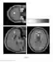 Fig. 03 - Compositions and methods for treating neurodegenerative diseases