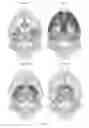 Fig. 04 - Compositions and methods for treating neurodegenerative diseases
