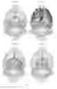 Fig. 05 - Compositions and methods for treating neurodegenerative diseases