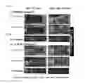 Fig. 04 - PHARMACEUTICAL COMPOSITION THAT IS ANTICANCER AND SUPPRESSES CANCER METASTASIS, CONTAINING, AS ACTIVE INGREDIENT, FUSION PEPTIDE SIMULTANEOUSLY TARGETING CANCER CELL AND TUMOR ASSOCIATED MACROPHAGE