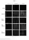 Fig. 08 - PHARMACEUTICAL COMPOSITION THAT IS ANTICANCER AND SUPPRESSES CANCER METASTASIS, CONTAINING, AS ACTIVE INGREDIENT, FUSION PEPTIDE SIMULTANEOUSLY TARGETING CANCER CELL AND TUMOR ASSOCIATED MACROPHAGE