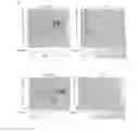 Fig. 07 - Tau-binding antibodies