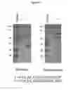 Fig. 30 - RAPID CLEARANCE OF ANTIGEN COMPLEXES USING NOVEL ANTIBODIES
