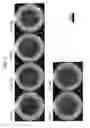 Fig. 12 - Culture container and cell culturing method and cell observation method using culture container