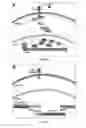 Fig. 18 - Compositions, systems and methods for cell therapy