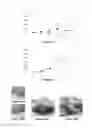 Fig. 14 - Pathology prognosis method