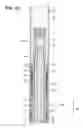 Fig. 02 - Gripping tool for removing a section of casing from a well