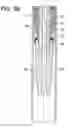 Fig. 07 - Gripping tool for removing a section of casing from a well