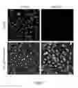 Fig. 02 - Modified Hydrocyanine Dyes for the Detection of Reactive Oxygen Species
