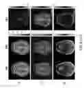 Fig. 09 - System and method for low rank approximation of high resolution MRF through dictionary fitting