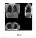 Fig. 06 - Dual flip angle multi-echo ultra-short echo time (DUFA-MUTE) magnetic resonance imaging (MRI) systems and methods