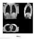 Fig. 07 - Dual flip angle multi-echo ultra-short echo time (DUFA-MUTE) magnetic resonance imaging (MRI) systems and methods
