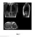 Fig. 08 - Dual flip angle multi-echo ultra-short echo time (DUFA-MUTE) magnetic resonance imaging (MRI) systems and methods